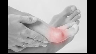 Effective methods for preventing and correcting hallux valgus