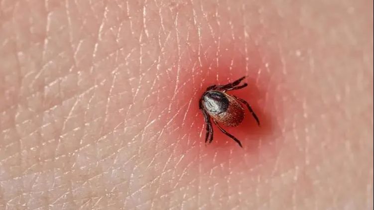 The Subtle Interplay of Nature: Exploring the Path of Tick Removal and Ecological Coexistence