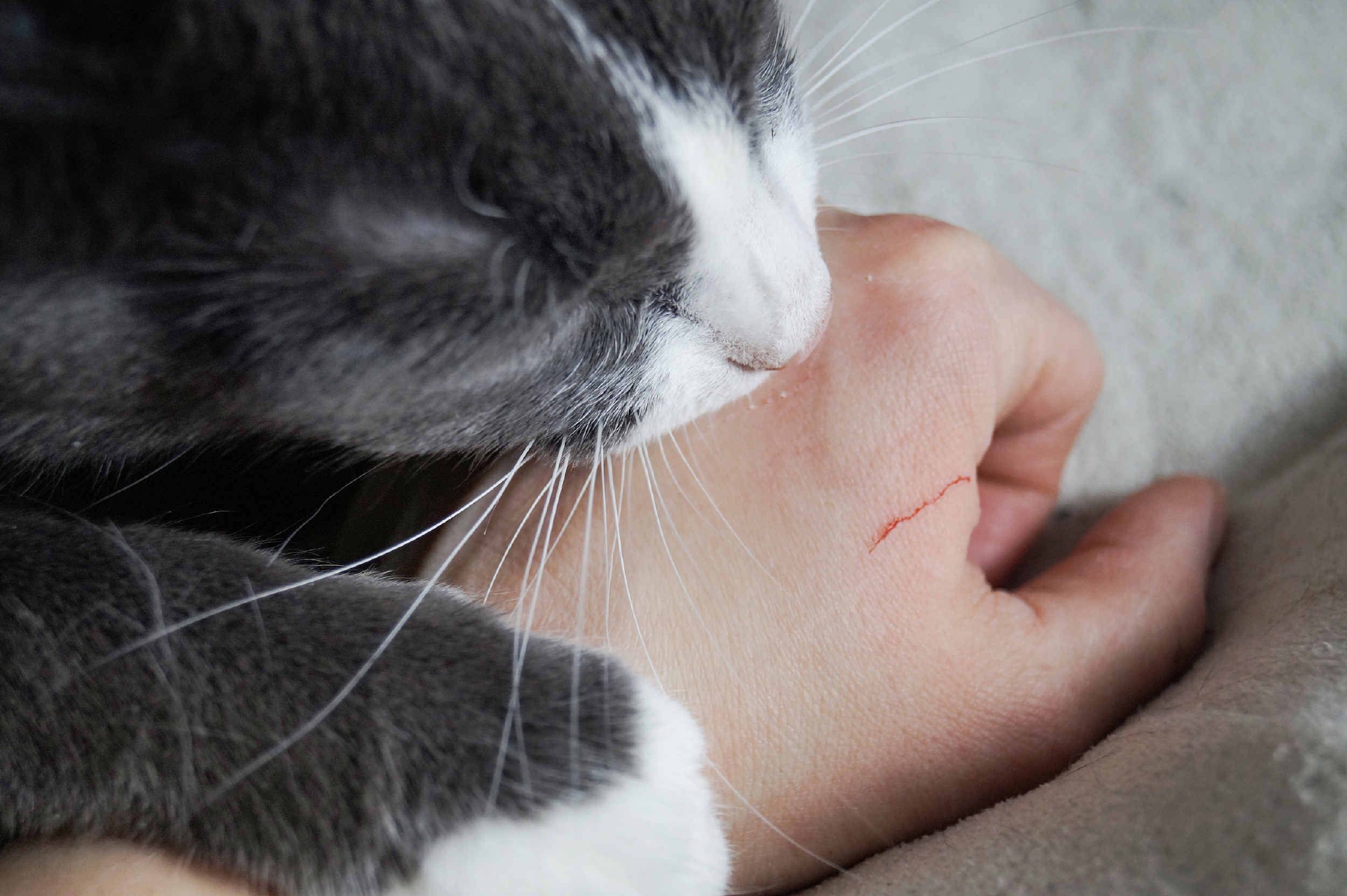 如何正确处理猫抓伤 | 齐齐写