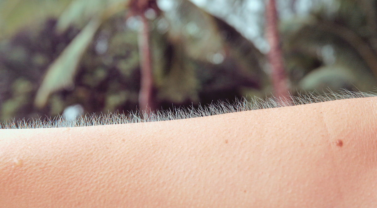 What is the cause of goose bumps?